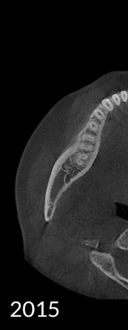2015